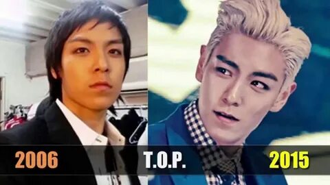 Bigbang TOP Plastic Surgery Before After - YouTube