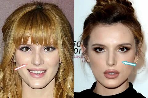 Did Bella Thorne Get Plastic Surgery? (Before & After 2022)