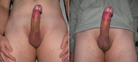 File:An erect penis after using a penis pump.JPG - Wikimedia