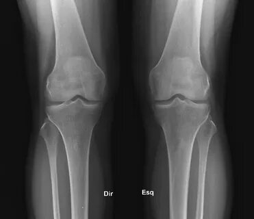 Diagnostics: Knee and Ankle X-rays - Taming the SRU