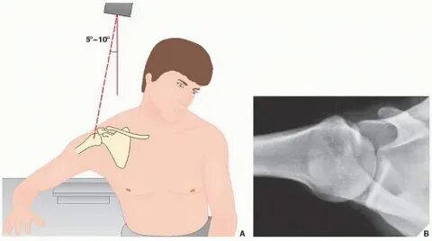 Upper Limb I: Shoulder Girdle Radiology Key