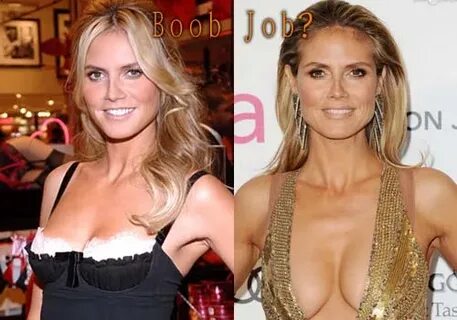 Heidi Klum Plastic Surgery - Top Celebrity Surgery