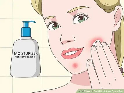 How to Get Rid of Acne Cysts Fast
