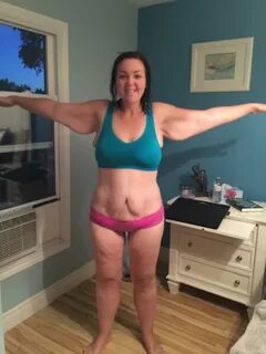 She Loses 210 Pounds And Just Wore A Bikini For The First Ti