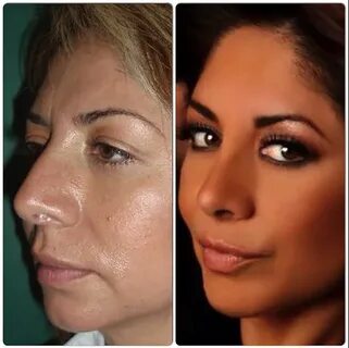 Dr. Arturo Munoz Meza Plastic Surgery in Mexico - 3 reviews,