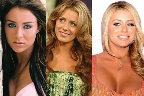 Photos: Aubrey O'Day got so much plastic surgery only to tur