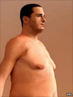 Increase in man boobs