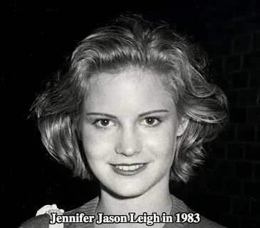 Jennifer Jason Leigh Plastic Surgery Before and After Photos