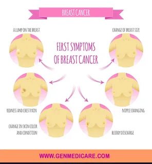 Breast cancer symptoms young age.