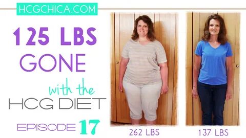 hCG Diet Interviews - Episode 17 -125 lbs GONE with the hCG 