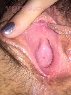 Septate hymen sex.