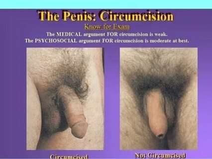 Circumcised cock best adult free images