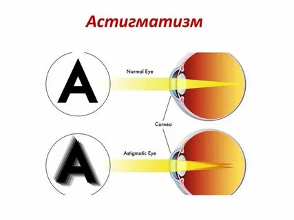 Микроскоп. Схема глаза. Таблицы для проверки зрения. Астигма