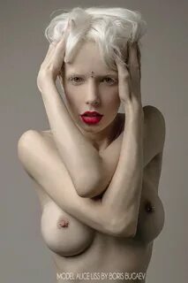 Free Nude Albino Women :: diluceinluce.eu