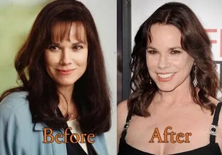 Barbara Hershey plastic surgery before and after - Plastic s