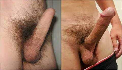 File:Uncircumcised and circumcised erect comparison.jpg - Wi
