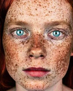 daisy casey trinder Beautiful freckles, Freckles girl, Redhe