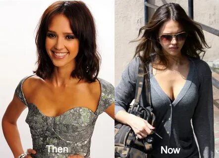 Jessica Alba Plastic Surgery Before and After Photos