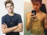 Dylan Sprouse Pictures Leak: "I was proud of my progress " (