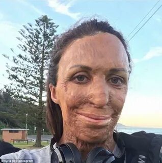 Burns survivor Turia Pitt predicted she was expecting boy