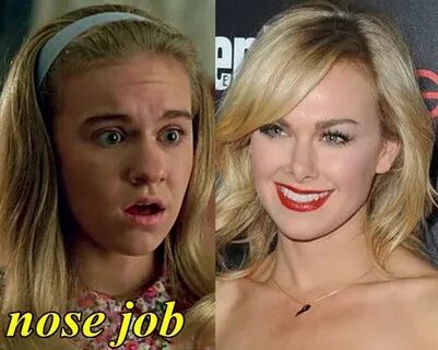 Laura Bell Bundy Nose Job, Plastic Surgery Fact or Rumors - 