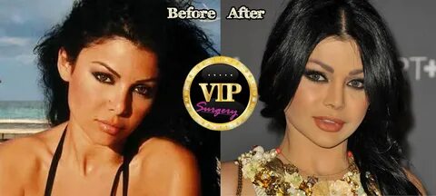 Haifa Before Plastic Surgery - Plastic Industry In The World