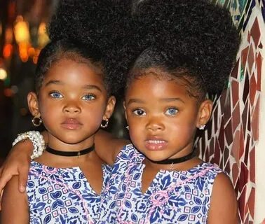 The True Blue Twins: Instagram Sensations with Gorgeous Eyes