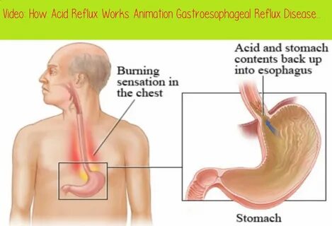 Acid reflux after sucking dick