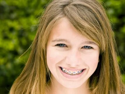 How Do Elastics (Rubber Bands) Help My Smile? Orthodontics b