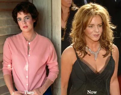 Stockard Channing Plastic Surgery Before and After Photos