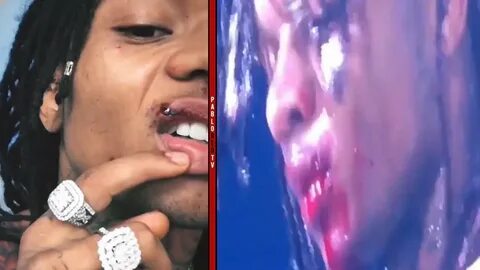 Swae Lee Gets His Face Busted! FAN THROW PHONE AT HIM DURING