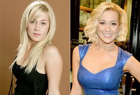 Kellie Pickler before and after plastic surgery - Plastic su