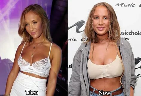 Niykee Heaton Plastic Surgery Before and After Photos - Late