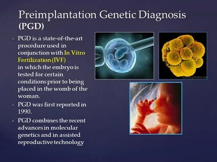 Preimplantation Genetic Diagnosis: An Overview Dr. Laila Bas