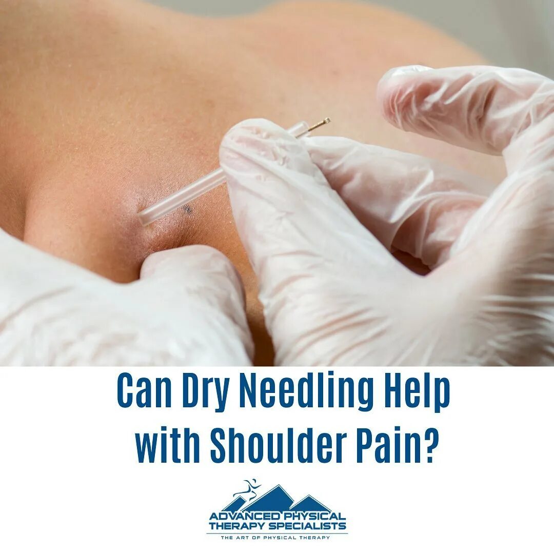 в Instagram: «I often get asked: “Does dry needling treat my shoulder pain?...