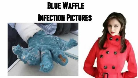 Blue Waffle Infection Pictures - YouTube