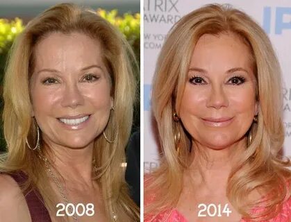 Kathie Lee Gifford Plastic Surgery Before & After Plastic su