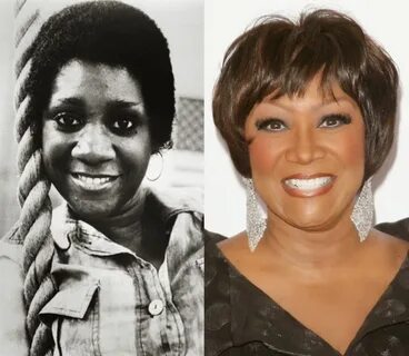 Patti LaBelle Plastic Surgery Nose job, Plastic surgery, Cel