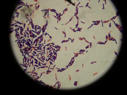 Lactobacillus acidophilus бактерии что это такое, значение д