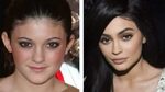 Kylie Jenner antes y después Mediavida