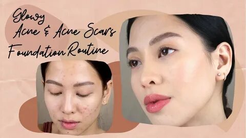 In depth: Glowy Acne & Acne Scars Foundation Routine in less