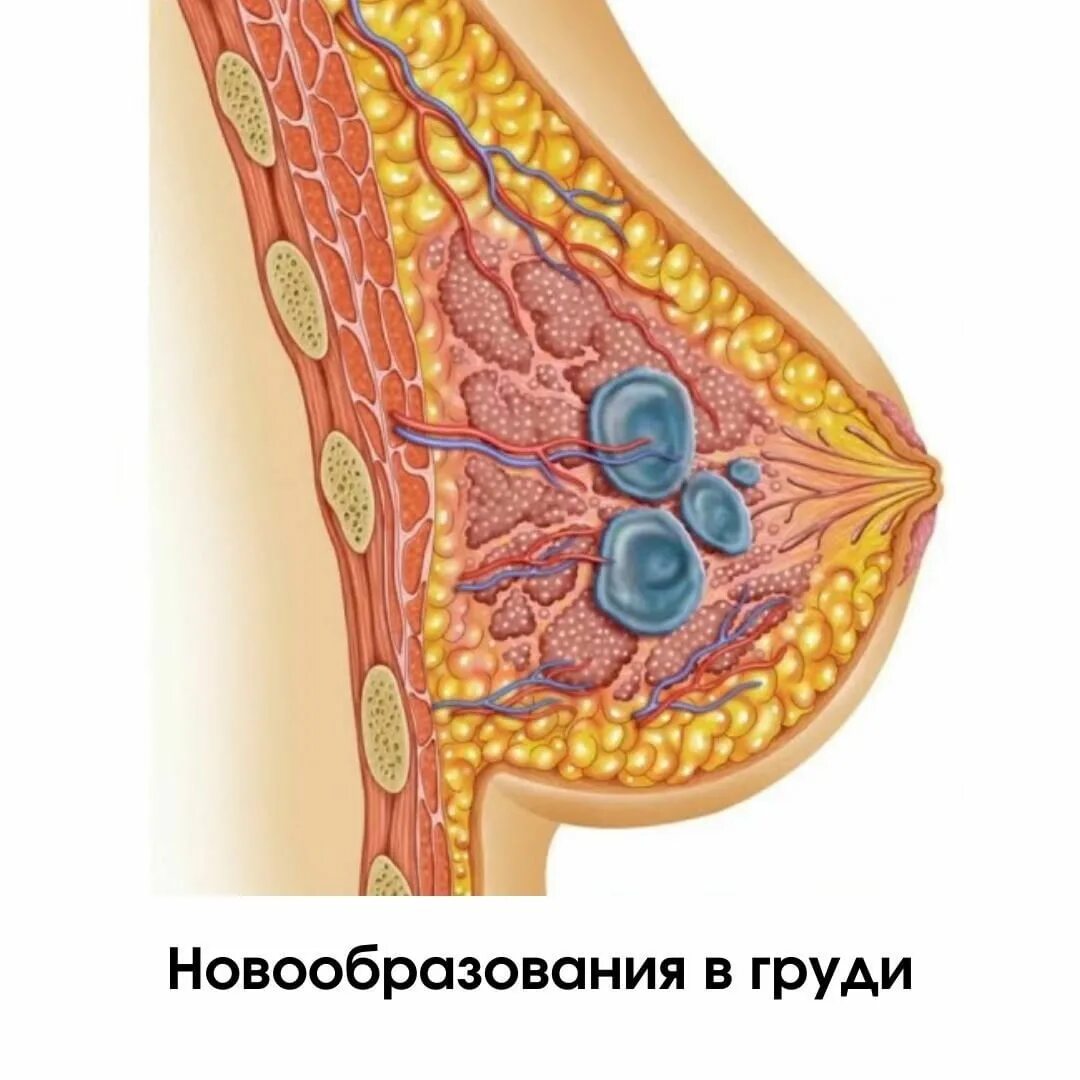 что находиться в женской груди фото 67