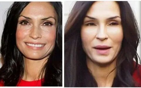 Famke Janssen Plastic Surgery Face - Find the Real Truth!