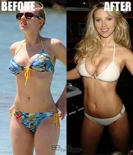 Scarlett Johansson Plastic surgery: Breast Reduction Before 