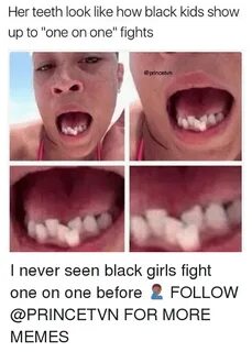 Her Teeth Look Like How Black Kids Show Up to One on One Fig