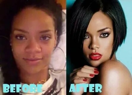 Rihanna Plastic Surgery Nose job, Plastic surgery, Nose surg