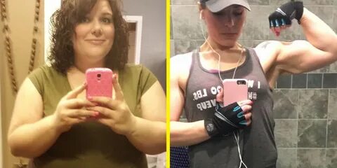 I Had Surgery to Lose Weight—but It Took Much More to Shed 1
