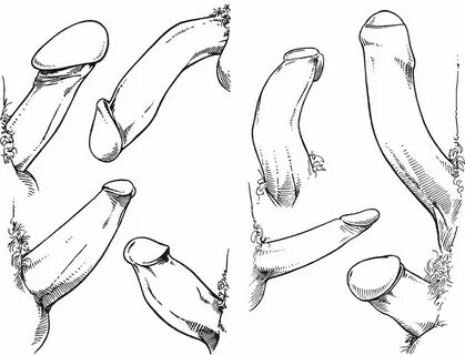 Разновидности пенисов