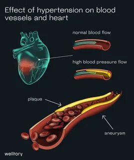 What is Blood pressure and how to analyze it with Welltory?