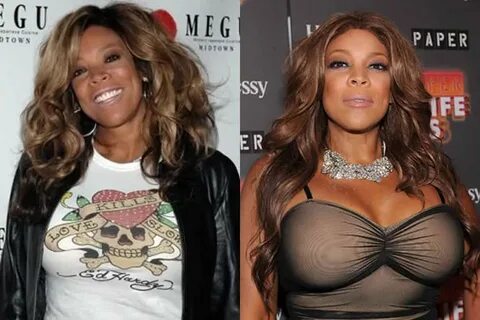 Did Wendy Williams Get Plastic Surgery? (Before & After 2018